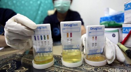 Pasangan yang mau Menikah akan dites Urine