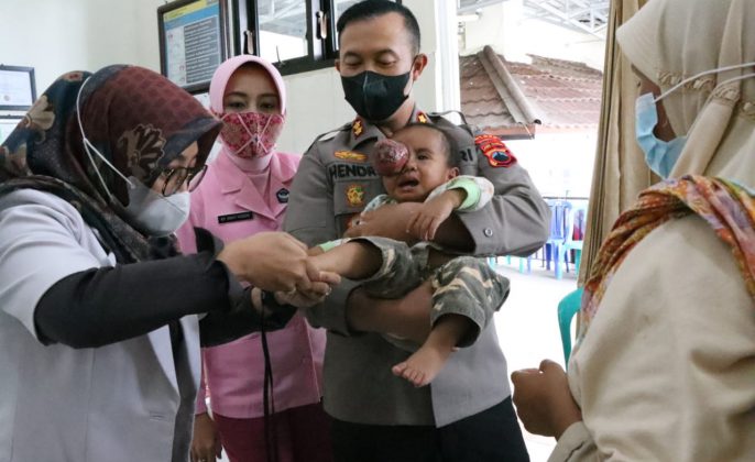 Kisah Haru Kapolres Banjarnegara Jemput Nuzailla Bocah 17 Bulan Penderita Tumor Mata Sebesar Bola Tenis