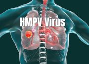 Gejala HMPV, Bagaimana Cara Membedakannya dengan Flu Biasa?
