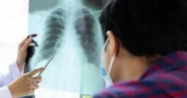 Kejar Target Eliminasi 2030, Dinkes Kota Madiun Intensifkan Temuan Kasus TBC